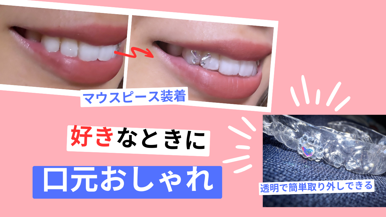 ジュエリーマウスピースとは